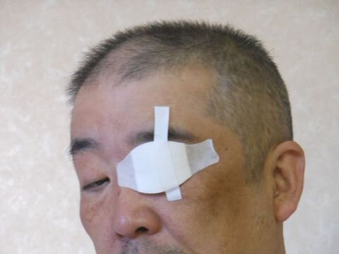 ドライアイ-thumb-480xauto-279.jpg